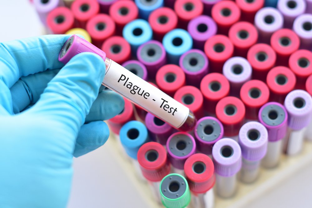 Plague in Russia explained. What Qatar residents should know after the Russia lab death